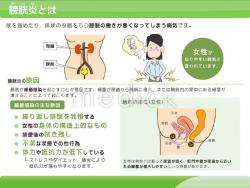 膀胱炎とはの説明スライド