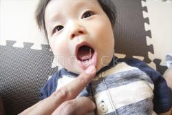 歯が生えかけ（前2本だけ）の写真