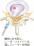 経皮的レーザー椎間板減圧術PLLDのイラスト