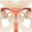 女性生殖器のイラスト