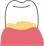歯垢のイラスト