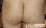 臀部の掻破痕の写真