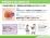 掌蹠膿疱症　扁桃腺の切除の説明スライド