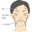 肝斑のできやすい部位のイラスト