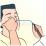 アルゴンプラズマ手術（照射）のイラスト