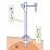 胃瘻器具のイラスト