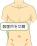 腹腔鏡の開腹のイラスト