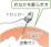 炭酸ガスの注入（腹部）のイラスト