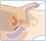 膀胱鏡検査（男性の尿道）のイラスト