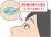 ドライスポットのイラスト