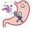 ピロリ菌の除菌のイラスト