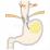 食道知覚過敏のイラスト