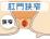 肛門狭窄のイラスト