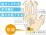 手根管症候群のイラスト