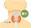 びまん性甲状腺腫のイラスト