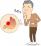 むねやけが起こる男性のイラスト