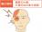 群発頭痛の痛む場所のイラスト