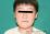 おたふくかぜによる耳下腺炎の写真