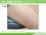 薬疹（播種状紅斑丘疹型）（症例写真）（５歳１ヶ月の女児）の説...