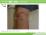ベーカー嚢腫（再発）（症例写真）（８歳７ヶ月男児）の説明スラ...