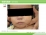 突発性発疹（症例写真）（７ヶ月の女児）の説明スライド